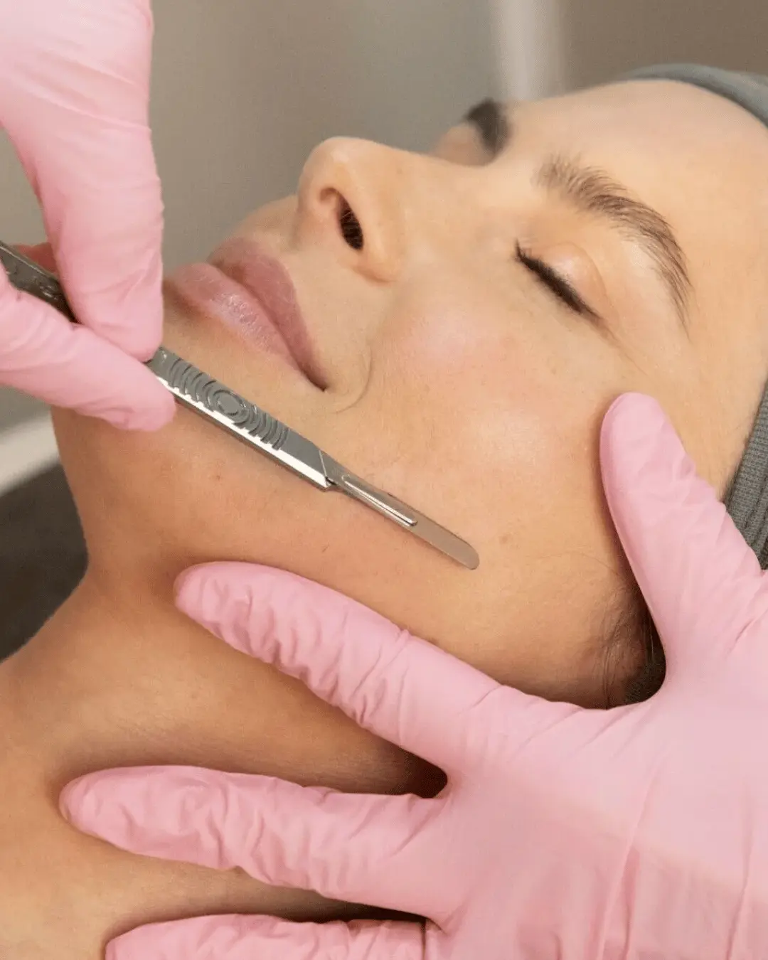 Dermaplaning
