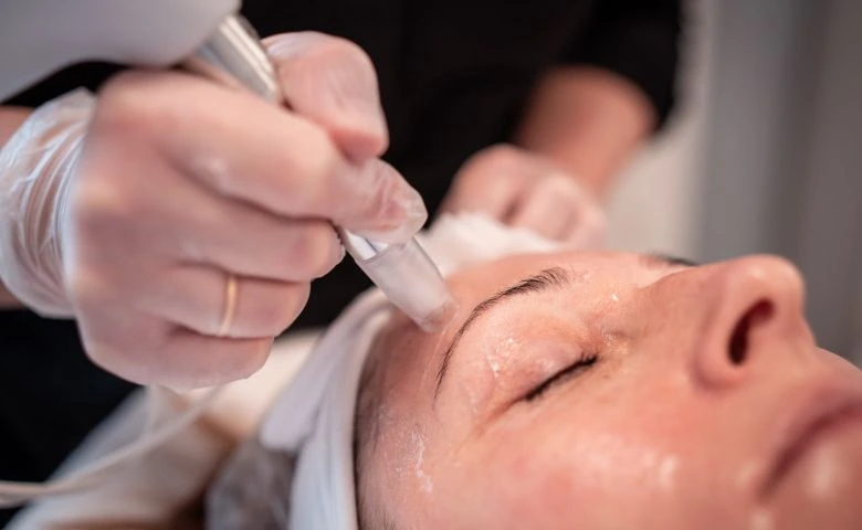 XCellaris PRO TWIST® skin needling handpiece and treatment tips
